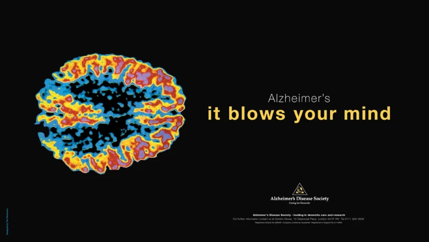 Alzheimers Month view post advert 02